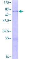 THAP7 Protein - 12.5% SDS-PAGE of human THAP7 stained with Coomassie Blue