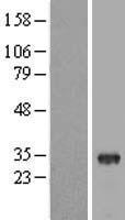 THAP8 Protein - Western validation with an anti-DDK antibody * L: Control HEK293 lysate R: Over-expression lysate