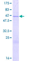 THAP8 Protein - 12.5% SDS-PAGE of human THAP8 stained with Coomassie Blue
