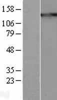 THBS1 / Thrombospondin-1 Protein - Western validation with an anti-DDK antibody * L: Control HEK293 lysate R: Over-expression lysate