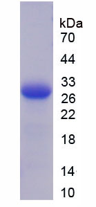 THBS2 / Thrombospondin 2 Protein - Recombinant  Thrombospondin 2 By SDS-PAGE