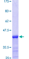 THBS4 / Thrombospondin 4 Protein - 12.5% SDS-PAGE Stained with Coomassie Blue.