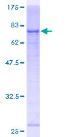 THEG Protein - 12.5% SDS-PAGE of human THEG stained with Coomassie Blue