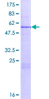 THEM5 Protein - 12.5% SDS-PAGE of human THEM5 stained with Coomassie Blue