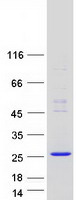 THEM6 / C8orf55 Protein - Purified recombinant protein THEM6 was analyzed by SDS-PAGE gel and Coomassie Blue Staining