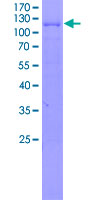 THEMIS / SPOT Protein - 12.5% SDS-PAGE of human THEMIS stained with Coomassie Blue