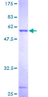 THG1L Protein - 12.5% SDS-PAGE of human ICF45 stained with Coomassie Blue