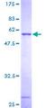 THG1L Protein - 12.5% SDS-PAGE of human ICF45 stained with Coomassie Blue