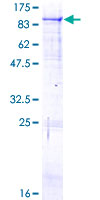 THNSL1 Protein - 12.5% SDS-PAGE of human THNSL1 stained with Coomassie Blue