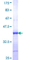 THNSL1 Protein - 12.5% SDS-PAGE Stained with Coomassie Blue.