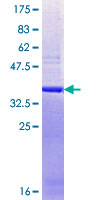 THOC2 Protein - 12.5% SDS-PAGE Stained with Coomassie Blue.