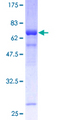 THOC3 Protein - 12.5% SDS-PAGE of human THOC3 stained with Coomassie Blue