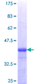 THOC3 Protein - 12.5% SDS-PAGE Stained with Coomassie Blue.