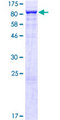 THOC5 Protein - 12.5% SDS-PAGE of human THOC5 stained with Coomassie Blue