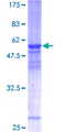 THOC6 Protein - 12.5% SDS-PAGE of human WDR58 stained with Coomassie Blue