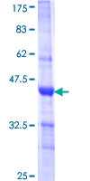 THOC6 Protein - 12.5% SDS-PAGE Stained with Coomassie Blue.