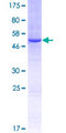THOC7 Protein - 12.5% SDS-PAGE of human THOC7 stained with Coomassie Blue