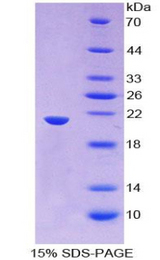 THOP1 / Thimet Oligopeptidase Protein - Recombinant Thimet Oligopeptidase 1 By SDS-PAGE