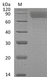 THPO / TPO / Thrombopoietin Protein - (Tris-Glycine gel) Discontinuous SDS-PAGE (reduced) with 5% enrichment gel and 15% separation gel.