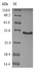 THPO / TPO / Thrombopoietin Protein - (Tris-Glycine gel) Discontinuous SDS-PAGE (reduced) with 5% enrichment gel and 15% separation gel.