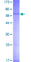 THPO / TPO / Thrombopoietin Protein - 12.5% SDS-PAGE of human THPO stained with Coomassie Blue