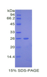 THPO / TPO / Thrombopoietin Protein - Recombinant Thyroid Peroxidase (TPO) by SDS-PAGE