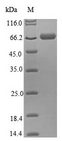 THRA / THR Alpha Protein - (Tris-Glycine gel) Discontinuous SDS-PAGE (reduced) with 5% enrichment gel and 15% separation gel.