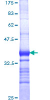 THRA / THR Alpha Protein - 12.5% SDS-PAGE Stained with Coomassie Blue.