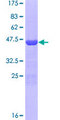 THRSP Protein - 12.5% SDS-PAGE of human THRSP stained with Coomassie Blue