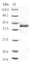 THRSP Protein - (Tris-Glycine gel) Discontinuous SDS-PAGE (reduced) with 5% enrichment gel and 15% separation gel.
