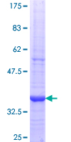 THRSP Protein - 12.5% SDS-PAGE Stained with Coomassie Blue.