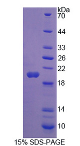 THRSP Protein - Recombinant Thyroid Hormone Responsive By SDS-PAGE