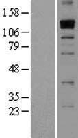 THSD1 / TMTSP Protein - Western validation with an anti-DDK antibody * L: Control HEK293 lysate R: Over-expression lysate