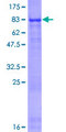 THSD4 Protein - 12.5% SDS-PAGE of human THSD4 stained with Coomassie Blue