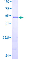 THTPA Protein - 12.5% SDS-PAGE of human THTPA stained with Coomassie Blue