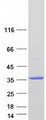 THTPA Protein - Purified recombinant protein THTPA was analyzed by SDS-PAGE gel and Coomassie Blue Staining