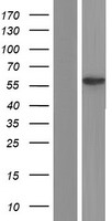 THUMPD2 Protein - Western validation with an anti-DDK antibody * L: Control HEK293 lysate R: Over-expression lysate