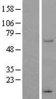THUMPD3 Protein - Western validation with an anti-DDK antibody * L: Control HEK293 lysate R: Over-expression lysate