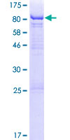 THUMPD3 Protein - 12.5% SDS-PAGE of human THUMPD3 stained with Coomassie Blue