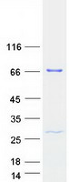 THUMPD3 Protein - Purified recombinant protein THUMPD3 was analyzed by SDS-PAGE gel and Coomassie Blue Staining