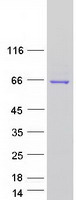 THUMPD3 Protein - Purified recombinant protein THUMPD3 was analyzed by SDS-PAGE gel and Coomassie Blue Staining