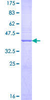 THY1 / CD90 Protein - 12.5% SDS-PAGE of human THY1 stained with Coomassie Blue