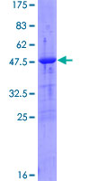 Thymidylate Kinase Protein - 12.5% SDS-PAGE of human DTYMK stained with Coomassie Blue