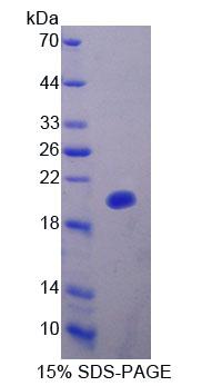 Thymidylate Kinase Protein - Recombinant Deoxythymidylate Kinase (DTYMK) by SDS-PAGE