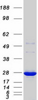 Thymidylate Kinase Protein - Purified recombinant protein DTYMK was analyzed by SDS-PAGE gel and Coomassie Blue Staining