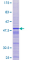 THYN1 / HSPC144 Protein - 12.5% SDS-PAGE of human THYN1 stained with Coomassie Blue