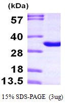 THYN1 / HSPC144 Protein