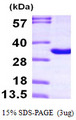 THYN1 / HSPC144 Protein