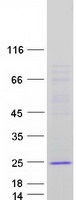 THYN1 / HSPC144 Protein - Purified recombinant protein THYN1 was analyzed by SDS-PAGE gel and Coomassie Blue Staining