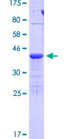 TIAF1 Protein - 12.5% SDS-PAGE of human TIAF1 stained with Coomassie Blue
